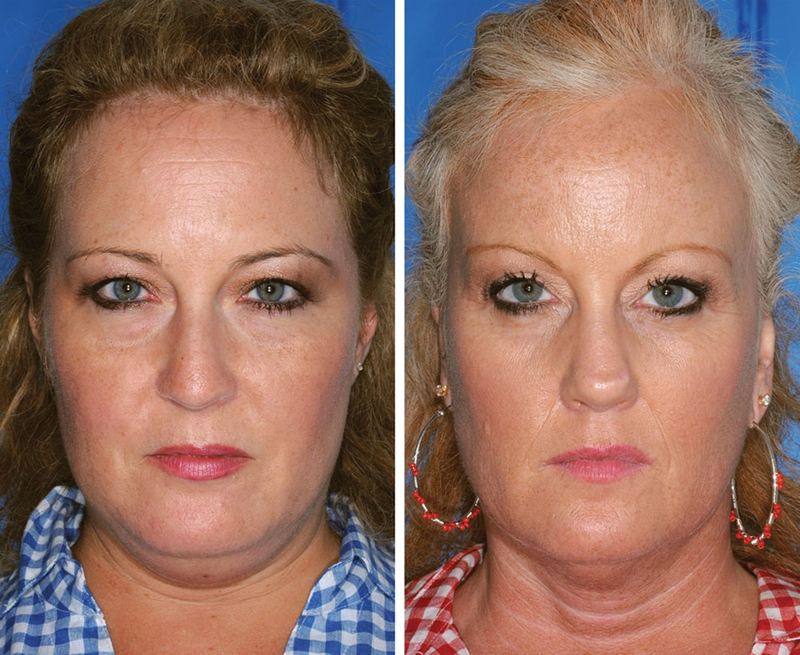 Illustration for article titled Guess which of these identical twins is the smoker